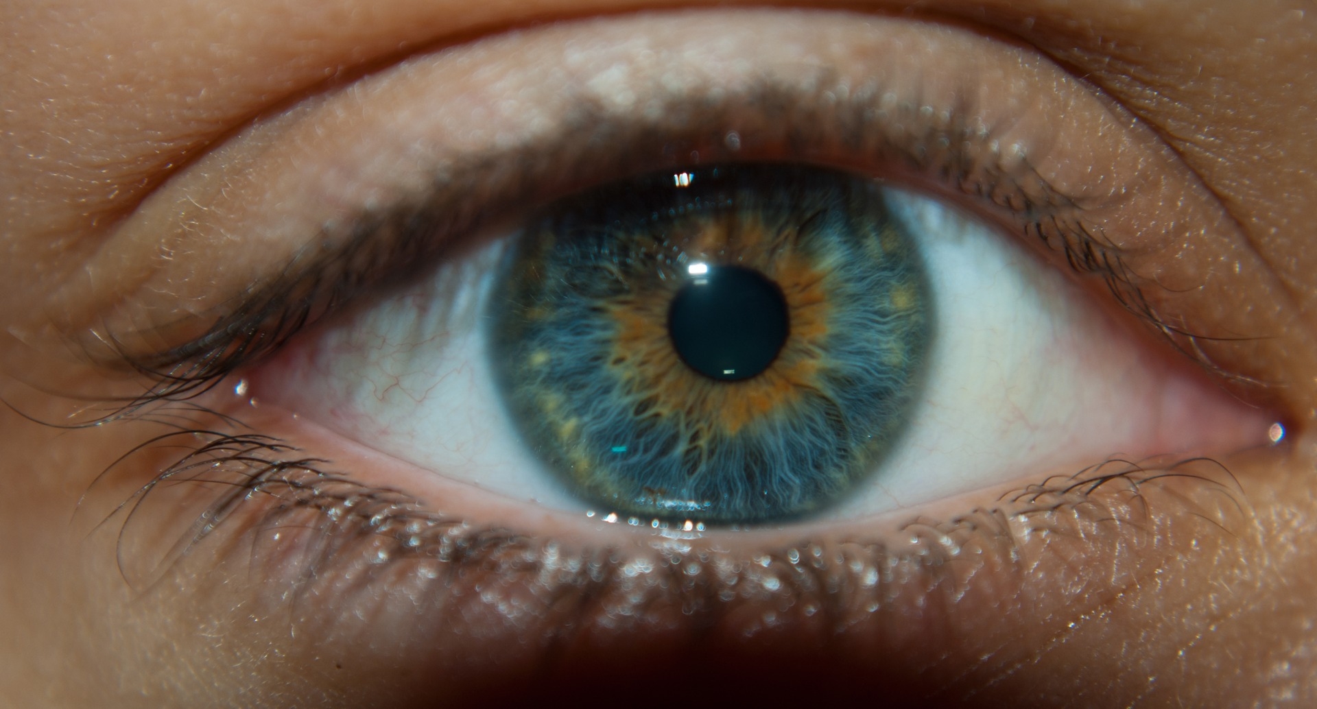 Пигмент радужной оболочки. Центральная гетерохромия глаз Карий и зеленый. Центральная гетерохромия зеленых глаз. Гетерохромия Центральная карие. Центральная гетерохромия голубой и Карий.