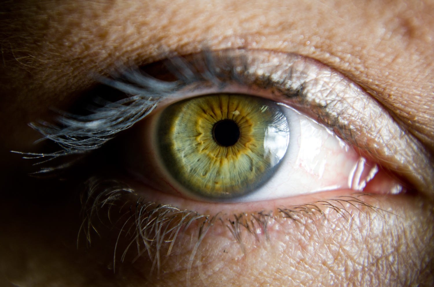 Описание желтых глаз. Центральная гетерохромия глаз. Болотный цвет глаз гетерохромия. Центральная гетерохромия хамелеон. Центральная гетерохромия зеленый Карий.