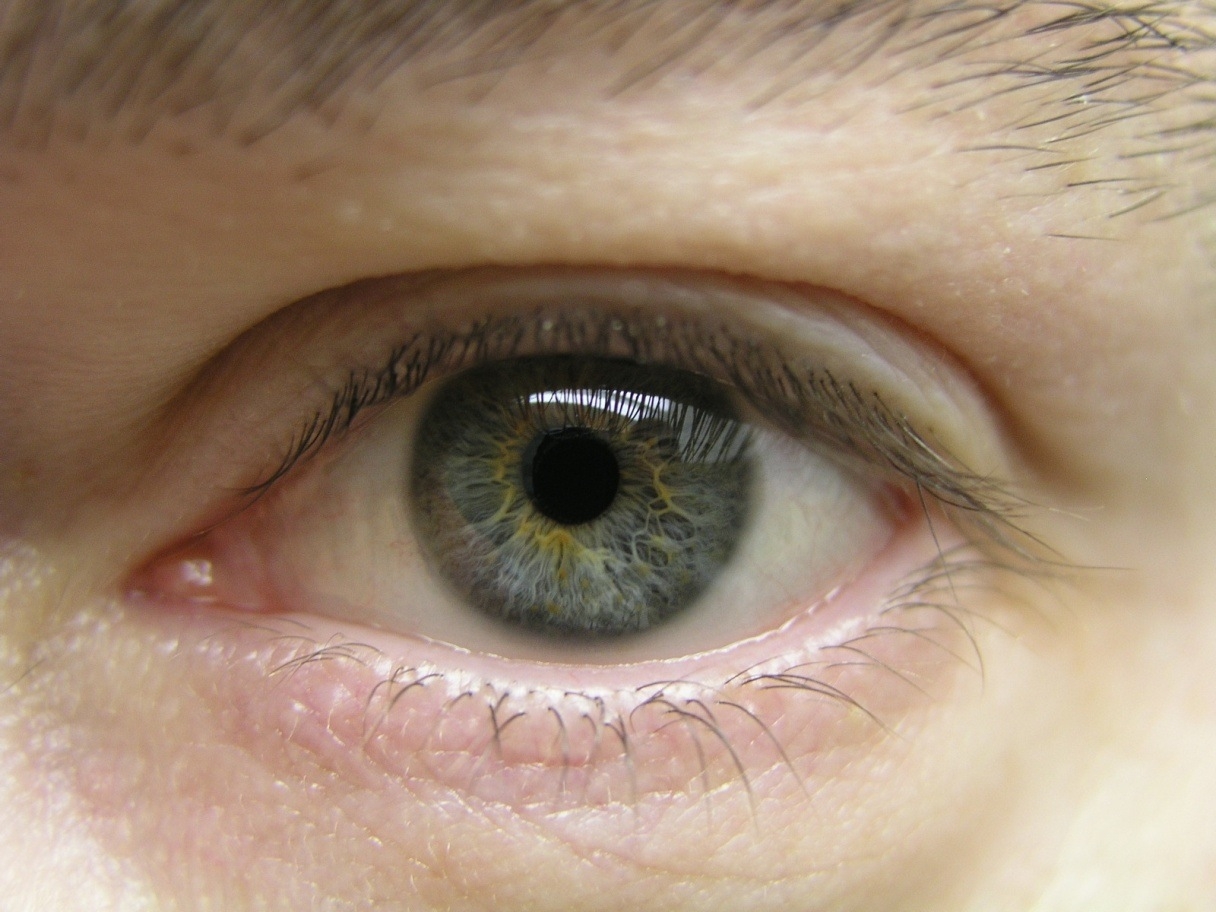 Почему глаза желтоватого. Болотный цвет глаз гетерохромия. Зелено серые глаза. Желто зелено карие глаза. Серо зелено карие глаза.