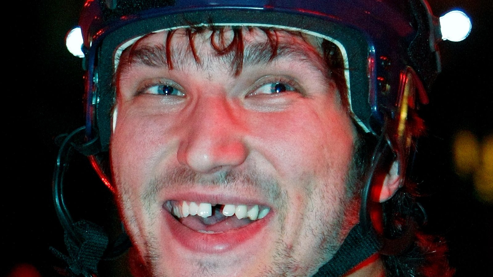 Овечкин без зуба. Хоккеист Овечкин улыбка. Беззубый хоккеист Овечкин.